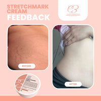 CLARITY ESSENTIALS STRETCHMARK REMOVER CREAM 50g