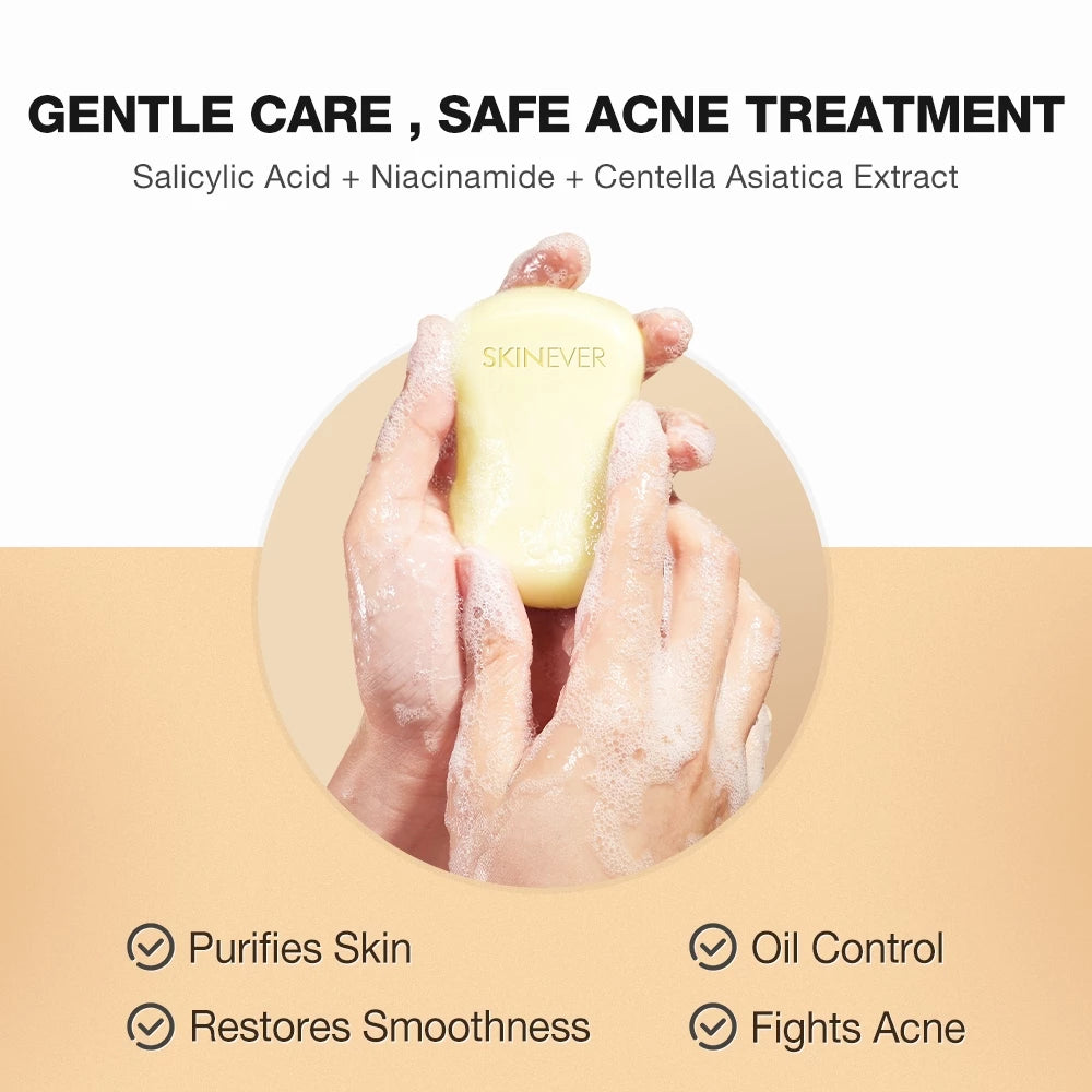 SKINEVER Salicylic Acid Refreshing Acne Soap 80g