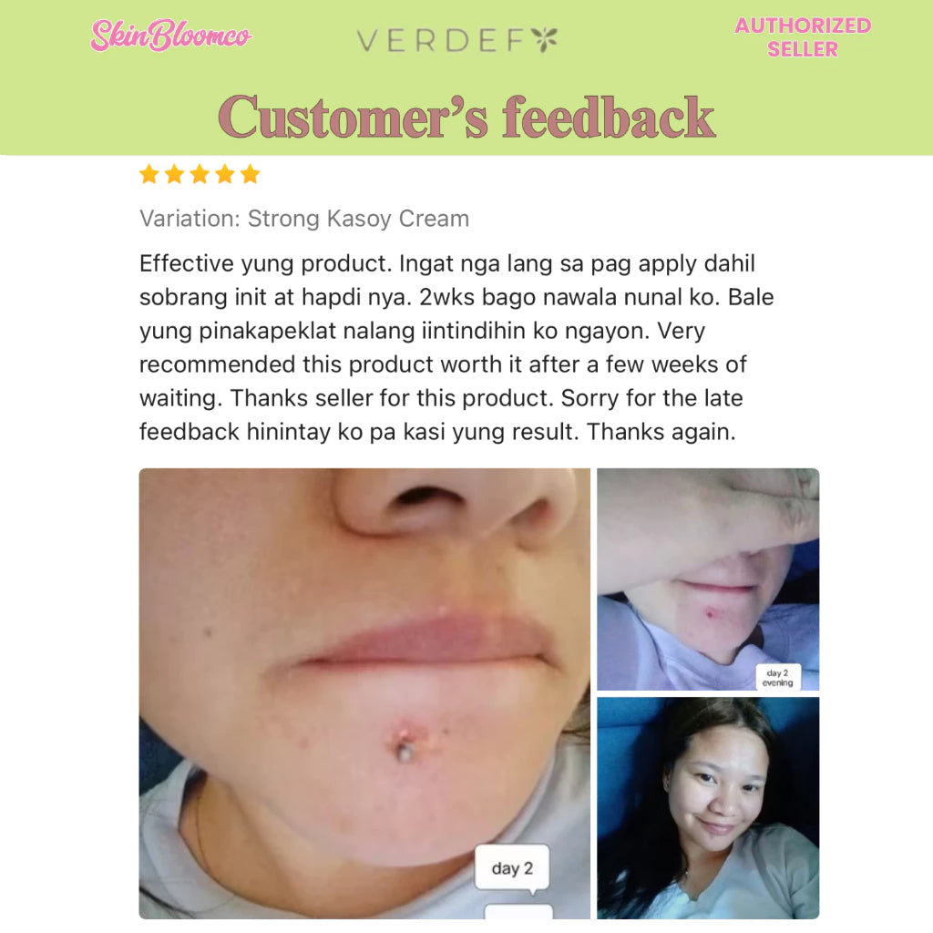 VERDEFY ULTIMATE DUO NEW STRONG KASOY CREAM & SCAR CREAM 5G FOR WARTS, MOLE, SKINTAGS, SYRINGOMA