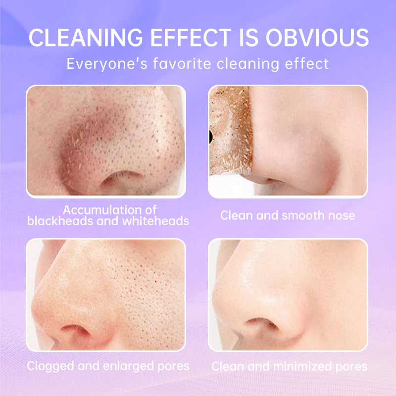 RtopR Blackhead Paper Blackhead Remover