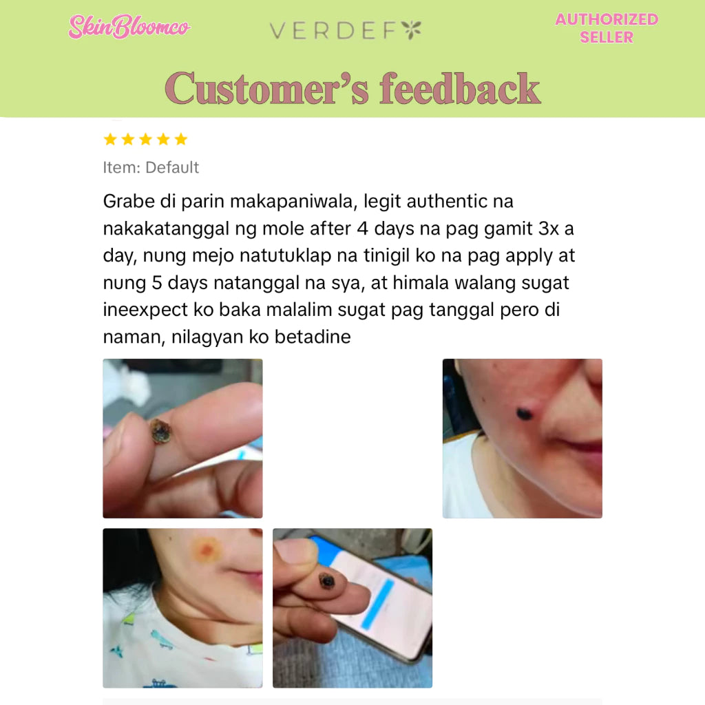 VERDEFY ULTIMATE DUO NEW STRONG KASOY CREAM & SCAR CREAM 5G FOR WARTS, MOLE, SKINTAGS, SYRINGOMA